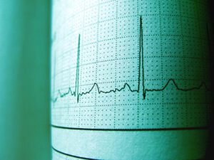 Machine Learning Improves Cardiovascular Risk Assessment