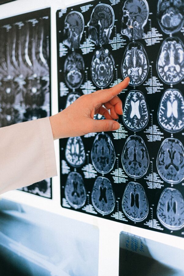 brain image